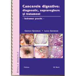 Cancere digestive