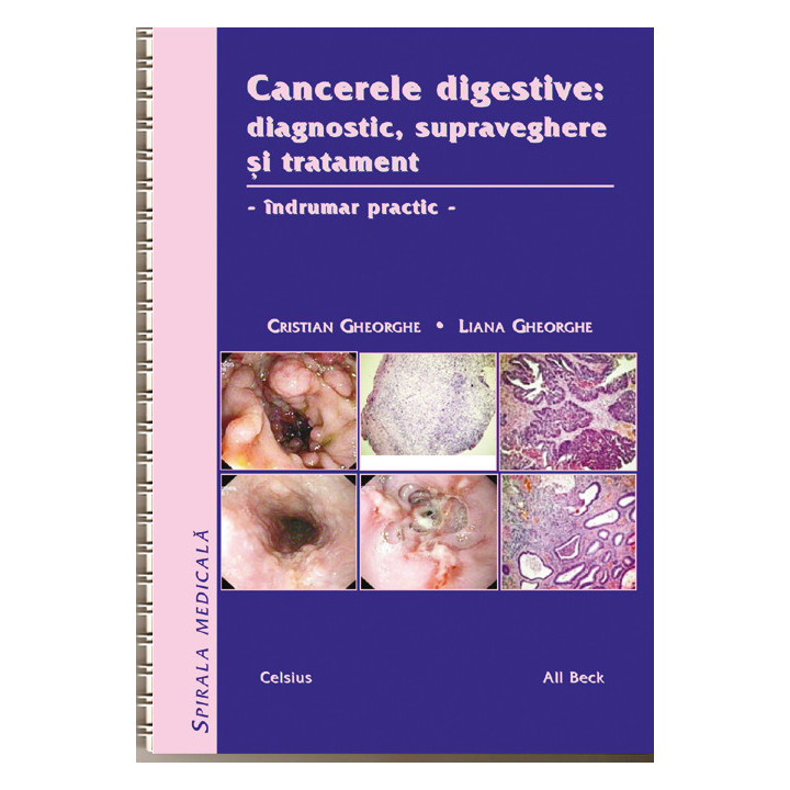 Cancere digestive