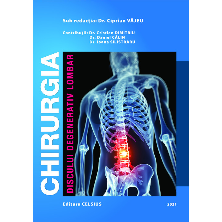 Chirurgia discului degenerativ lombar