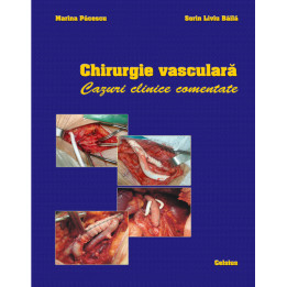 Chirurgie vasculara. Cazuri clinice comentate