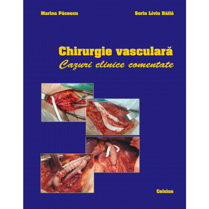 Chirurgie vasculara. Cazuri clinice comentate