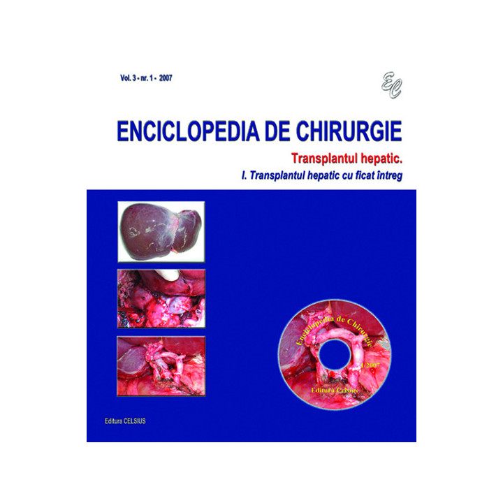 Colectia Enciclopedia de Chirurgie Nr. 1 2007