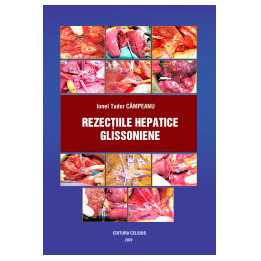 Rezecțiile hepatice extraglissoniene