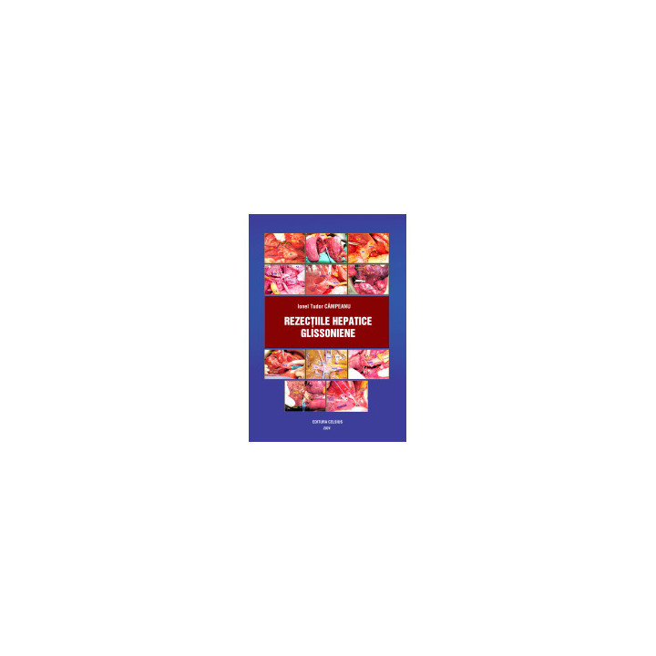 Rezecțiile hepatice extraglissoniene