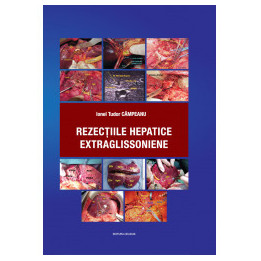 Rezectiile Hepatice Glissoniene