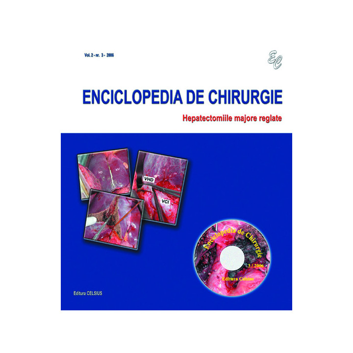 Colectia Enciclopedia de Chirurgie Nr. 3 2006